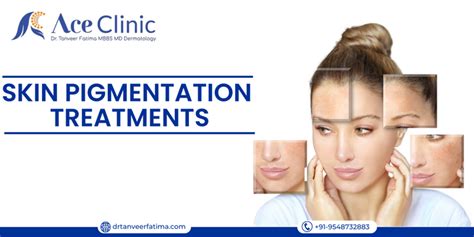 Best 5 Skin Pigmentation Treatments - Dr Tanveer Fatima