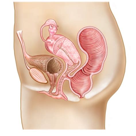 Rectovaginal Fistula And Cross Section Of Female Reproductive Organs