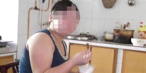 90后女生不吃碳水半年狂瘦46斤！结果脱发怕冷，夏天也要穿棉袄手机新浪网