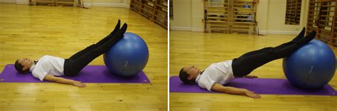 Gym Ball Exercises For Scoliosis Sufferers Scoliosis Sos