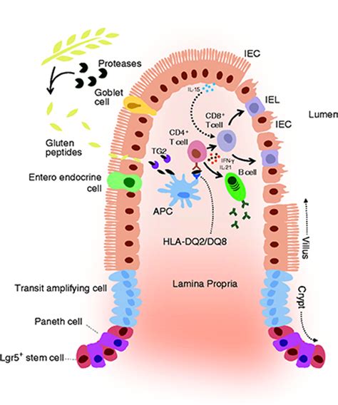 Celiac Diseaseonchip Modeling A Multifactorial Disease In Vitro