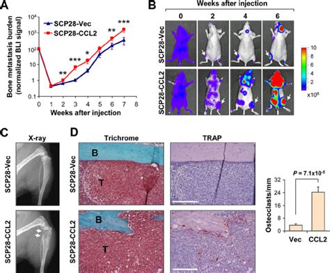 CCL2 Overexpression Enhances Osteolytic Bone Metastasis And Associated