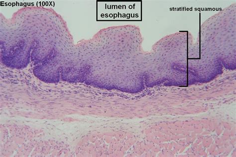 C Stratified Squamous 100x 1