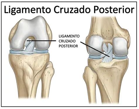 Ligamento Cruzado Posterior Especialista Em Joelho