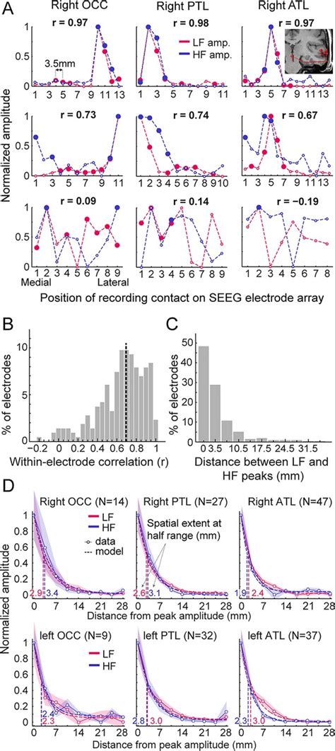 Low And High Frequency Intracranial Neural Signals Match In The Human