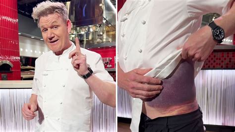 Gordon Ramsay Says Hes Lucky To Be Alive After Bike Accident And