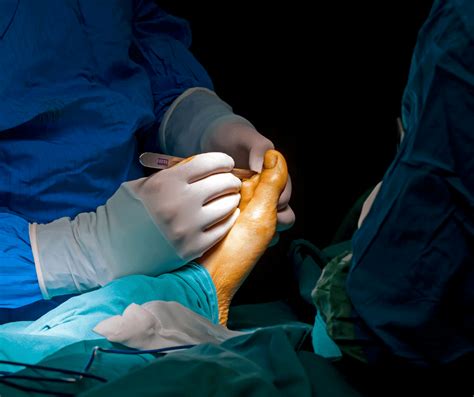 Foot and Ankle Surgery in Cary, NC | Ankle and Foot Doctors