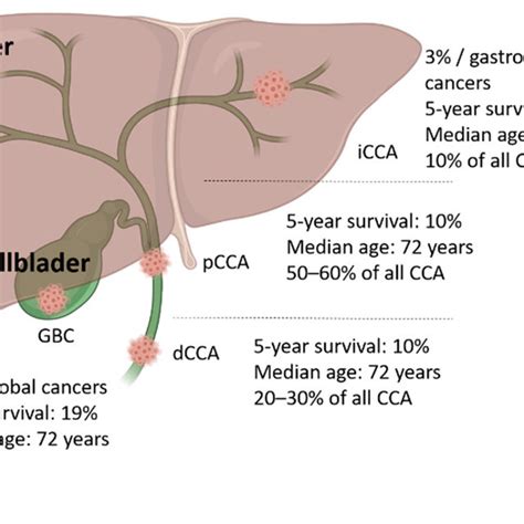 Pdf Molecular And Immunological Characterization Of Biliary Tract Cancers A Paradigm Shift