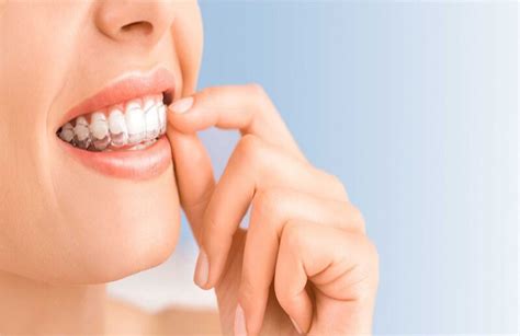 Best Invisible Braces in Mumbai |dentheal.in