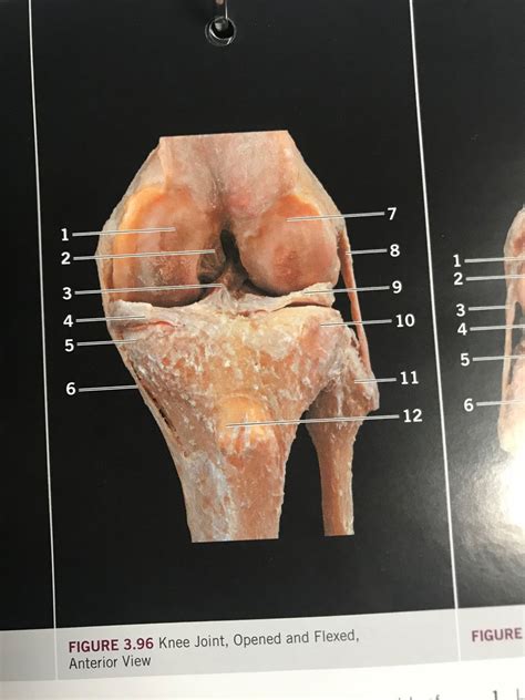 Knee Joint Opened And Flexed Anterior View Diagram Quizlet