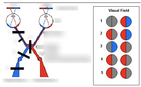 Visual Fields Diagram Diagram Quizlet