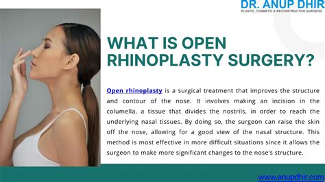 Ppt Open Rhinoplasty Surgery Dr Anup Dhir Powerpoint Presentation