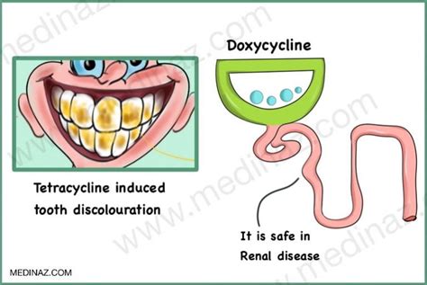 Tetracycline Antibiotics Uses Mechanism Of Action Side Effects Medinaz