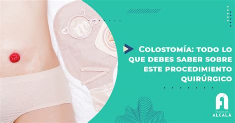 Colostomía Todo Lo Que Debes Saber Sobre Este Procedimiento Quirúrgico