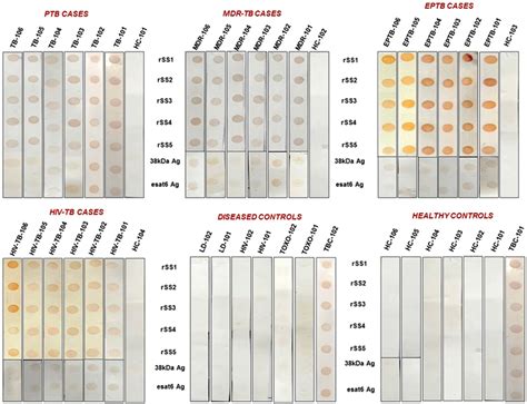 Dot Blot Results Showing The Reactivity Of Purified Recombinant