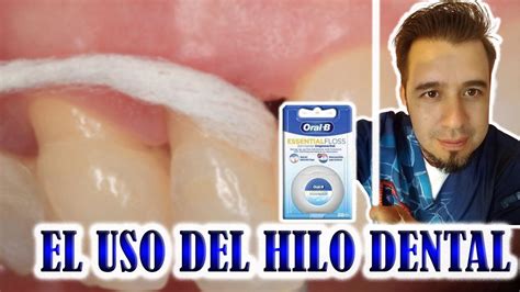 Como Usar El Hilo Dental De Manera Correcta Brito Maxilo BRDENT YouTube