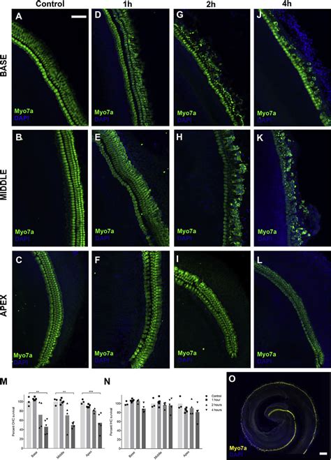 S Pneumoniae Induced Hair Cell Damage In Cochlear Explants Ael Download Scientific Diagram