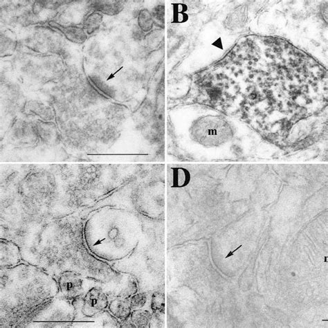 Node Of Ranvier Labeling In The Pns Rat And Mouse Sciatic And Cns