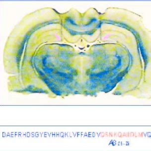 (A) A typical photomicrograph of a coronal section through the ... 