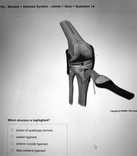 SOLVED PAL Models Skeletal System Joints Quiz Question 14