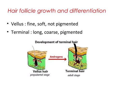 Approach To Hirsutism Ppt