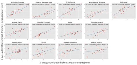 Cortical Thickness Measurements At The 13 Cortical Regions Shown Are