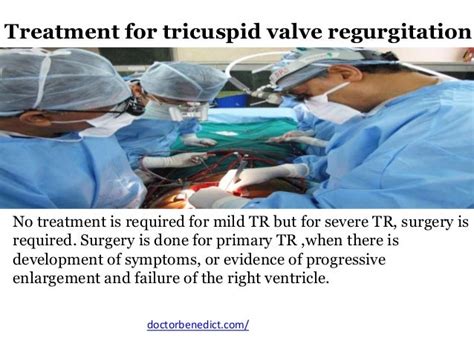 Know about tricuspid valve regurgitation