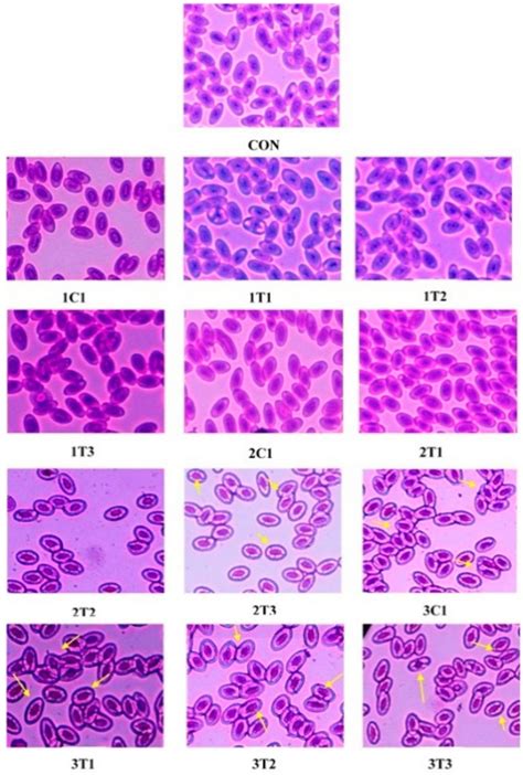 Photomicrographs Of Erythrocytes With Normal Nuclei In The Peripheral