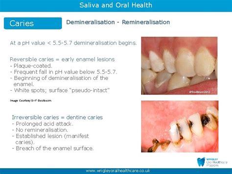 Saliva And Oral Health Part Maintaining Oral