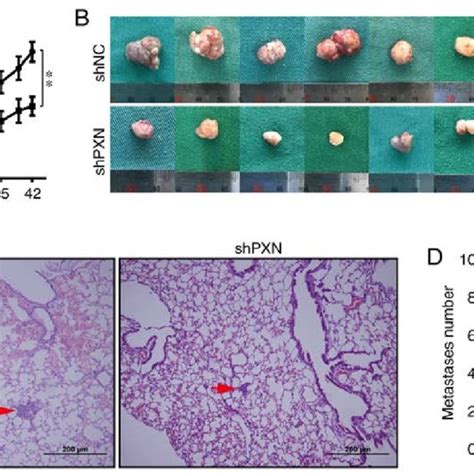 Downregulation Of Pxn Inhibits Tumourigenesis In Vivo A Tumour