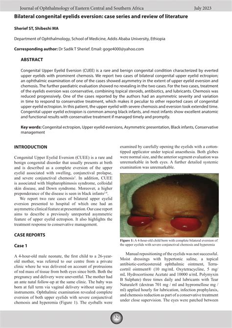 Pdf Bilateral Congenital Eyelids Eversion Case Series And Review Of