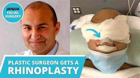 My Rhinoplasty Journey Plastic Surgeon Gets His Nose Done Dr