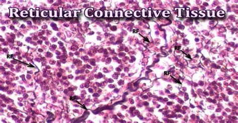 Reticular Connective Tissue - Assignment Point