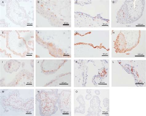 Protein Expression Of Side Population Trophoblast Up Regulated Genes In