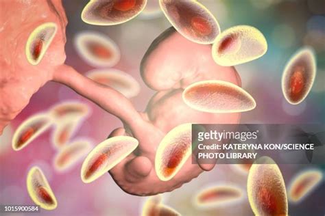 68 Toxoplasma Gondii High Res Illustrations Getty Images