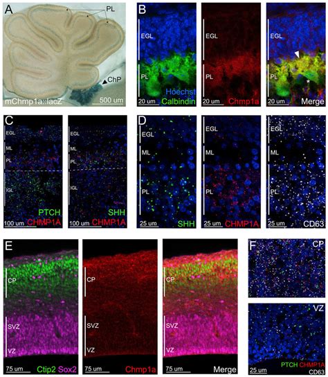 Chmp A Is Expressed In Neurons And Choroid Plexus Epithelial Cells In