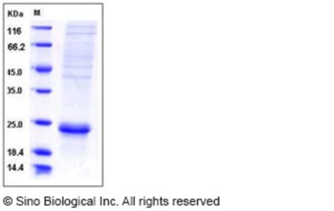 Sino Biological Human Il F Interleukin F Protein His Tag