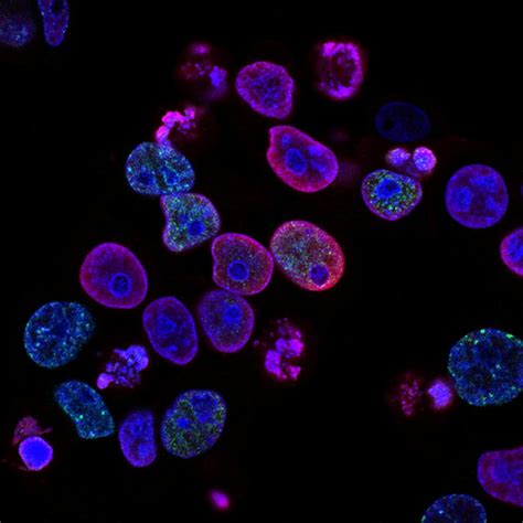 Neurodegenerative Diseases and the Quest for Early Biomarkers