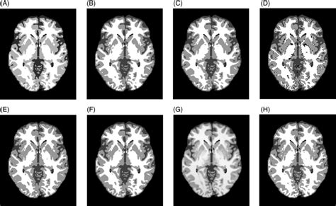 The Segmentation Results Obtained By A Classical Markov Random Field