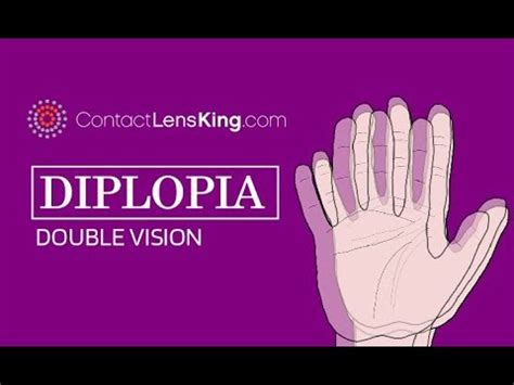 Diplopia - Treatment, Causes, Varieties | Diseases 2024