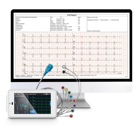 Mobile 6/12-Lead EKG/ECG Machine Fits into Your Pocket, with Auto ...