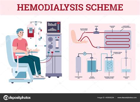 Hemodialyse Renale Schema Met Apparatuur Voor De Behandeling Van