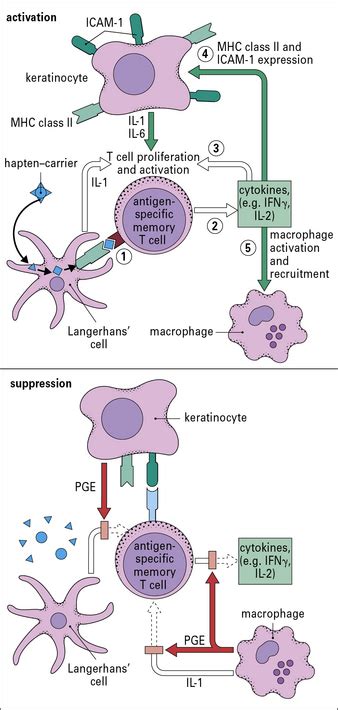 Hypersensitivity (Type IV) | Oncohema Key