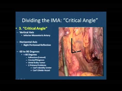 Splenic Flexure Of Colon