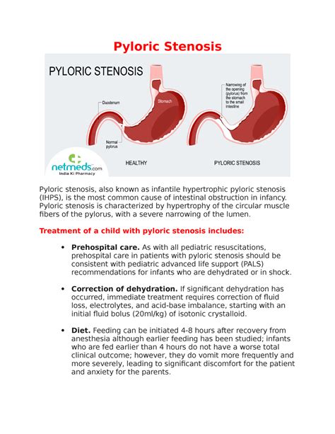 Pyloric Stenosis Pyloric Stenosis Pyloric Stenosis Also Known As