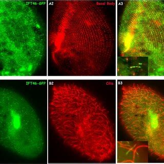 Cilia defects caused by the depletion of IFT46 and IFT80 in Paramecium ...