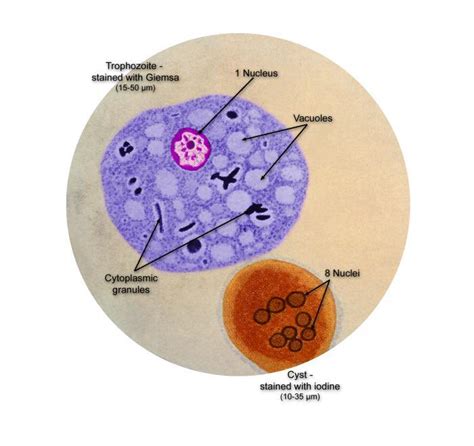 Entamoeba Histolytica Cyst With Label