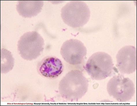 Plasmodium Malariae Cell Atlas Of Haematological Cytology