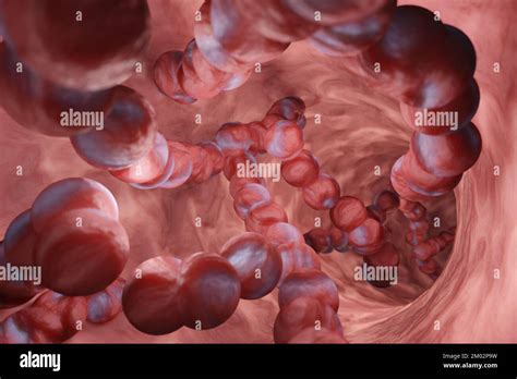 Strep A Bacterial Structure In A Throat Illustration Of The Infection