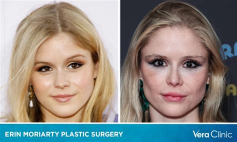 Erin Moriarty Plastic Surgery: Debunking the Rumors